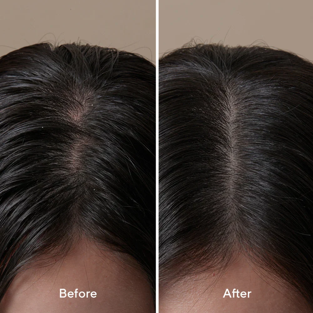 Aromatica Rosemary Root Enhancer 100ml - Image 2