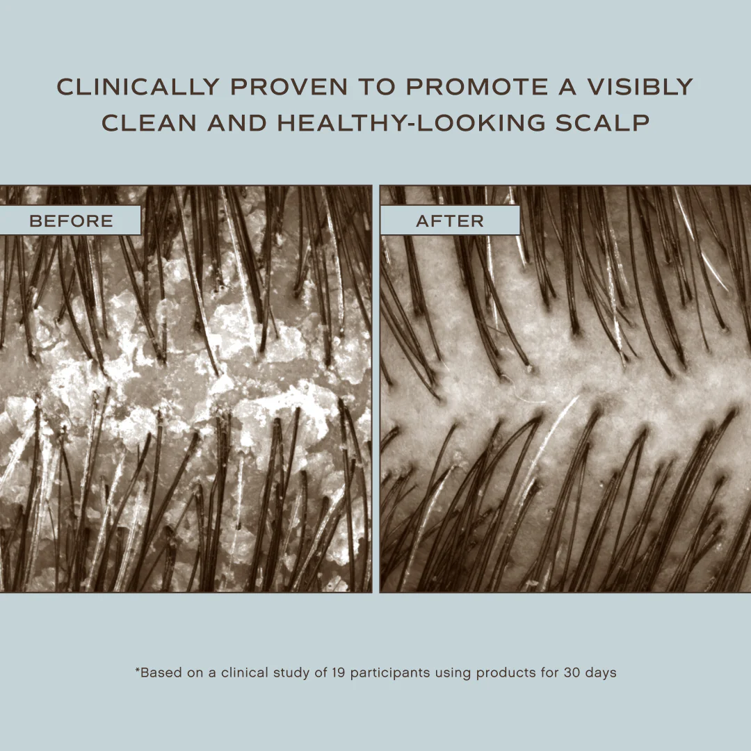 Innersense Hair Renew Scalp Hairbath - Image 3