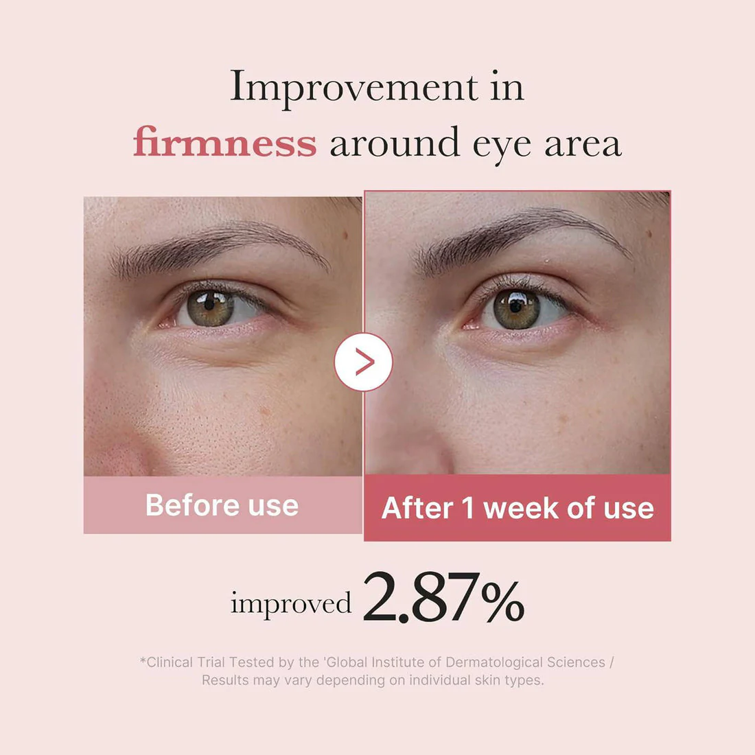 Medicube PDRN Pink Peptide Eye Cream 30ml - Image 6